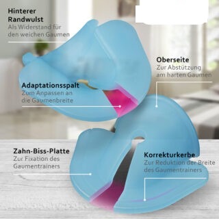 Aufbau des Gaumentrainers mit Adaptationsspalt, Randwulst, Zahn-Biss-Platte, Oberseite und Korrekturkerbe